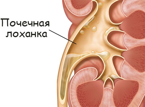 Кракен это даркнет маркетплейс